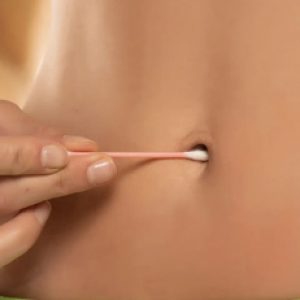Belly button or navel infection – Important things to know!!