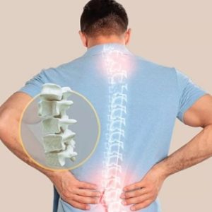 Does Bone Strength Decrease After 30? Dr. Arun Kumar Explains the Truth