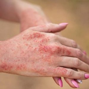 Hidden health issues that are revealed by the abnormalities in the hands!!