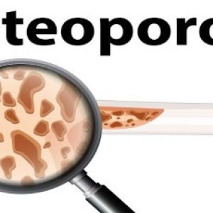 Low levels of testosterone can lead to fractures in men, take care!!