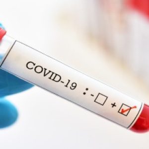 Blood sample tube positive with COVID-19 or novel coronavirus 2019 found in Wuhan, China