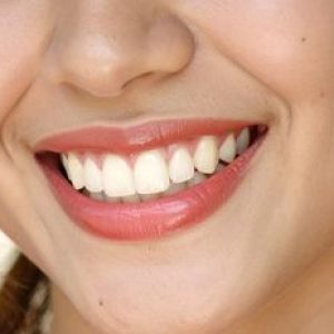 Effective Ways to Keep Your Teeth Healthy